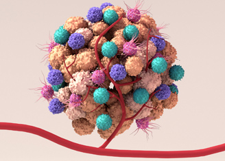From “Cold” to “Hot” Tumors with Masked Interleukin-12 