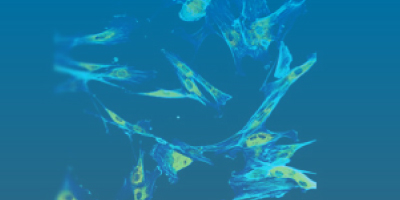 Harness the Power of Custom Polyclonal Antibodies to Uncover Novel Proteins
