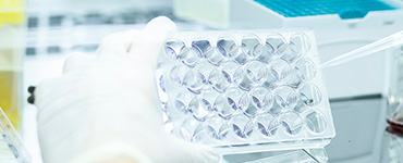 Cellular Immunity Evaluation
