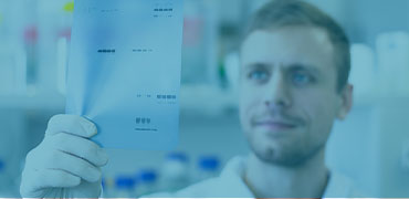 Protein Electrophoresis and Blotting