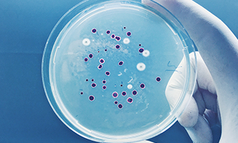Cloning Strains