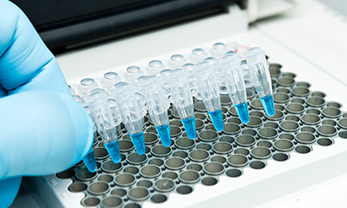 3. PCR-based DNA Synthesis (1980s)
