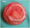 coupler of angiogenesis and osteogenesis in bone