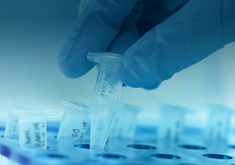 PCR Reagents