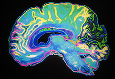Scientists developed an innovative, label-free approach for visualizing whole-brain changes in Alzheimer’s disease