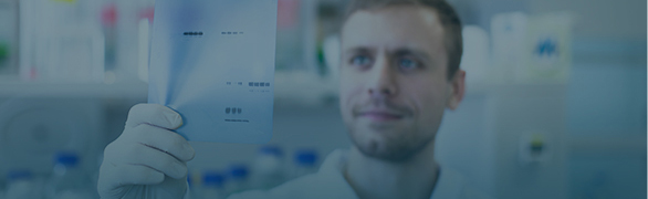 Protein Electrophoresis and Blotting