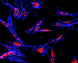 TRM Cells Survey Melanoma Cells