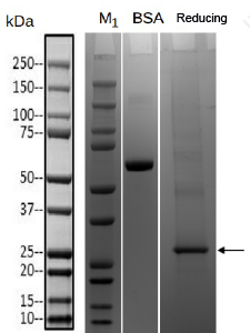 Transmembrane Proteins- PAQR2